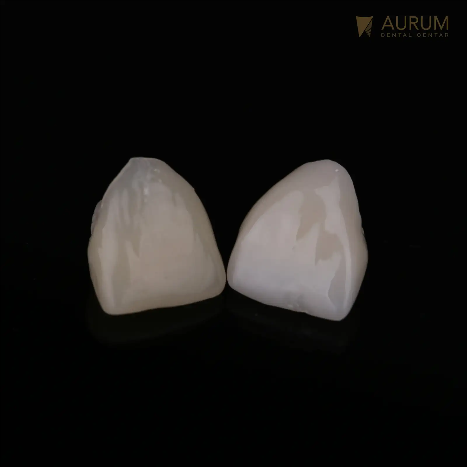 Navlake (krunice) za zube