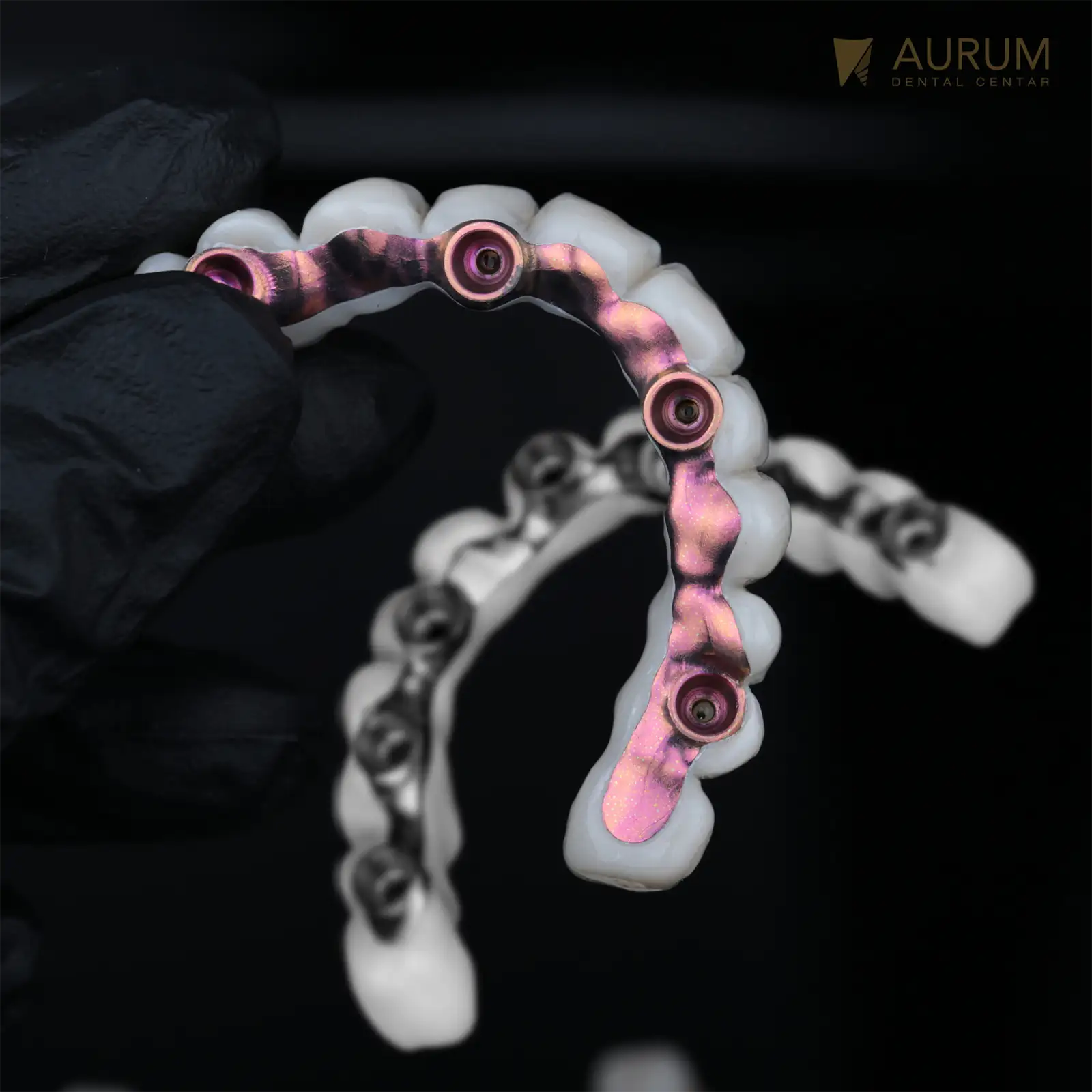 Zašto raditi ALL ON 6, ako postoji ALL ON 4.