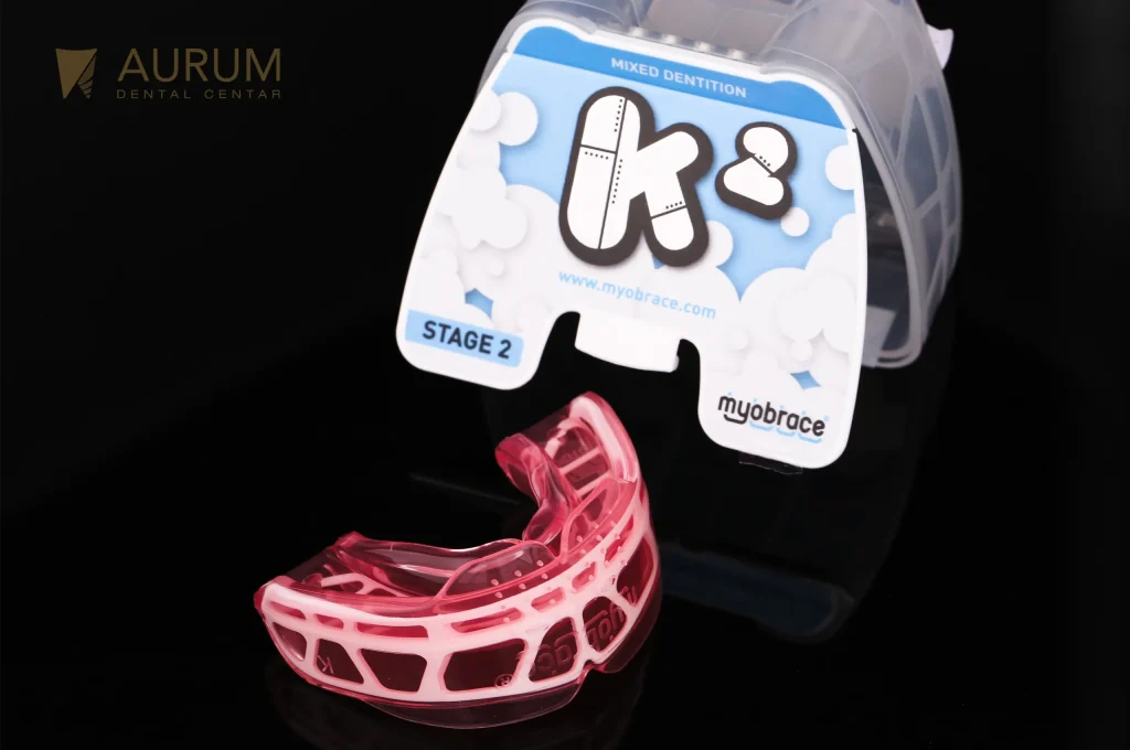 Myobrace, mobilni aparatic kao ortodontska terapija u Aurum Dental Centru