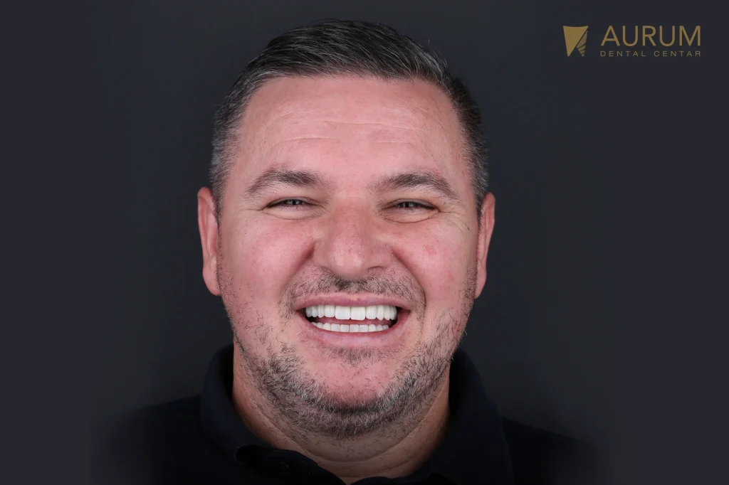 Pacijent u Aurum Dental Centru sa urađenim implantatima i krunama
